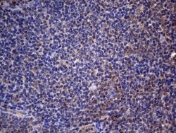CRP Monoclonal Antibody (OTI4B4), TrueMAB , OriGene 30 &mu;L; Unconjugated:Antibodies,
