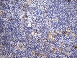 CRP Monoclonal Antibody (OTI1G10), TrueMAB , OriGene 100 &mu;L; Unconjugated:Antibodies,