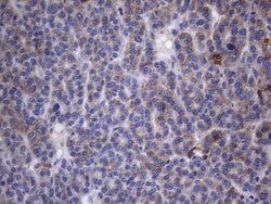 CRP Monoclonal Antibody (OTI1G10), TrueMAB , OriGene 100 &mu;L; Unconjugated:Antibodies,