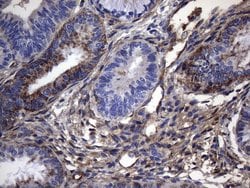 CRP Monoclonal Antibody (OTI1G10), TrueMAB , OriGene 100 &mu;L; Unconjugated:Antibodies,
