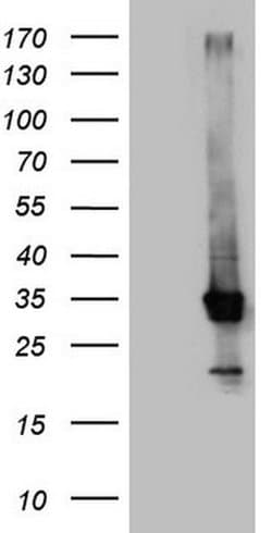 CRP Monoclonal Antibody (OTI4B4), TrueMAB , OriGene 30 &mu;L; Unconjugated:Antibodies,