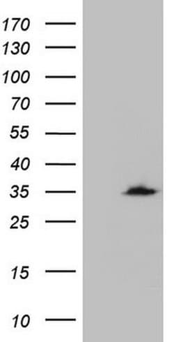 CRP Monoclonal Antibody (OTI1G10), TrueMAB , OriGene 100 &mu;L; Unconjugated:Antibodies,