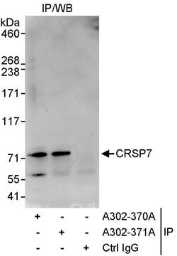 CRSP7 Rabbit anti-Human, Polyclonal, Bethyl Laboratories 10 &mu;L | Buy Online | Bethyl Laboratories, Inc | Fisher Scientific