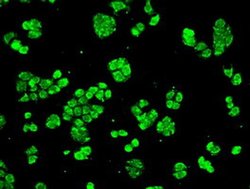 CRYAB Mouse anti-Human, Clone: OTI3E3, liquid, TrueMAB 100 &mu;L; Unconjugated:Antibodies,