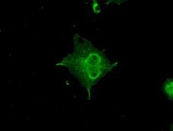 CRYAB Mouse anti-Human, Clone: OTI4A6, liquid, TrueMAB 100 &mu;L; Unconjugated:Antibodies,