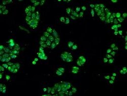 CRYAB Mouse anti-Human, Rat, Clone: OTI6D11, liquid, TrueMAB 30 &mu;L;