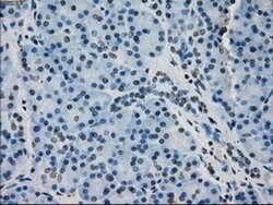 CRYAB Mouse anti-Human, Rat, Clone: OTI6A9, liquid, TrueMAB 100 &mu;L;