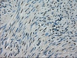 CRYAB Mouse anti-Human, Clone: OTI4A6, liquid, TrueMAB 100 &mu;L; Unconjugated:Antibodies,