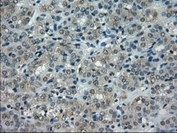 CRYAB Mouse anti-Human, Rat, Clone: OTI6D11, liquid, TrueMAB 30 &mu;L;