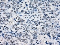CRYAB Mouse anti-Human, Clone: OTI6G5, lyophilized, TrueMAB 100 &mu;g;