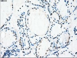 CRYAB Mouse anti-Human, Clone: OTI6G5, lyophilized, TrueMAB 100 &mu;g;