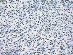 CRYAB Mouse anti-Human, Clone: OTI6G5, lyophilized, TrueMAB 100 &mu;g;
