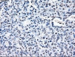 CRYAB Mouse anti-Human, Clone: OTI6G5, lyophilized, TrueMAB 100 &mu;g;