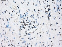 CRYAB Mouse anti-Human, Clone: OTI6G5, lyophilized, TrueMAB 100 &mu;g;