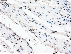 CRYAB Mouse anti-Human, Clone: OTI6G5, lyophilized, TrueMAB 100 &mu;g;