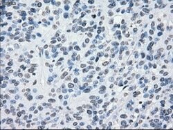 CRYAB Mouse anti-Human, Clone: OTI6G5, lyophilized, TrueMAB 100 &mu;g;