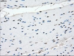 CRYAB Mouse anti-Human, Clone: OTI6G5, lyophilized, TrueMAB 100 &mu;g;
