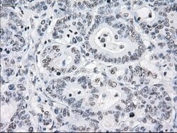 CRYAB Mouse anti-Human, Clone: OTI6G5, lyophilized, TrueMAB 100 &mu;g;