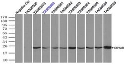 CRYAB Mouse anti-Human, Clone: OTI3E3, liquid, TrueMAB 100 &mu;L; Unconjugated:Antibodies,