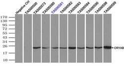 CRYAB Mouse anti-Human, Rat, Clone: OTI6A9, liquid, TrueMAB 100 &mu;L;