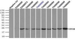 CRYAB Mouse anti-Human, Clone: OTI4A6, liquid, TrueMAB 100 &mu;L; Unconjugated:Antibodies,