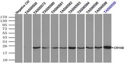 CRYAB Mouse anti-Human, Clone: OTI6G5, lyophilized, TrueMAB 100 &mu;g;