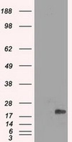 CRYAB Mouse anti-Human, Clone: OTI3E3, liquid, TrueMAB 100 &mu;L; Unconjugated:Antibodies,
