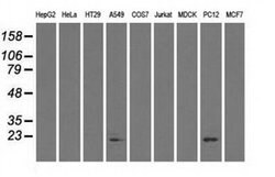 CRYAB Mouse anti-Human, Rat, Clone: OTI6A9, liquid, TrueMAB 100 &mu;L;