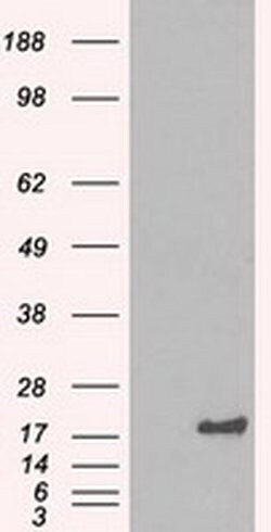 CRYAB Mouse anti-Human, Clone: OTI4A6, liquid, TrueMAB 100 &mu;L; Unconjugated:Antibodies,