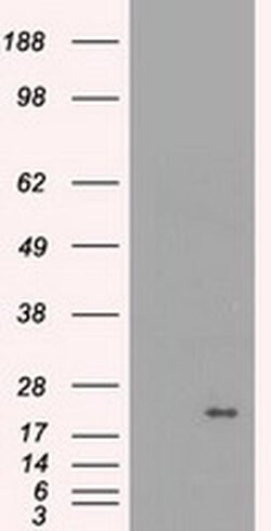 CRYAB Mouse anti-Human, Rat, Clone: OTI6D11, liquid, TrueMAB 30 &mu;L;