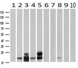 CRYAB Mouse anti-Human, Rat, Clone: OTI6D11, liquid, TrueMAB 30 &mu;L;