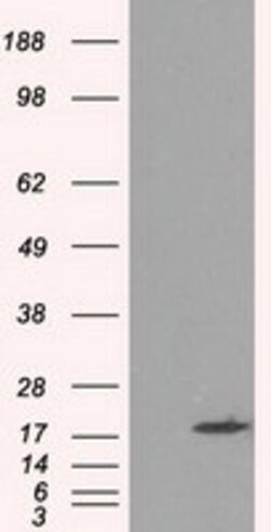 CRYAB Mouse anti-Human, Clone: OTI6G5, lyophilized, TrueMAB 100 &mu;g;