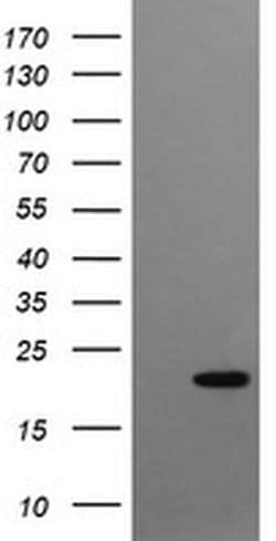 CRYGC Monoclonal Antibody (OTI1D6), TrueMAB , OriGene 100 &mu;L; Unconjugated:Antibodies,