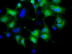 CRYM Mouse anti-Human, Clone: OTI1B5, lyophilized, TrueMAB 100 &mu;g; Unconjugated:Antibodies,