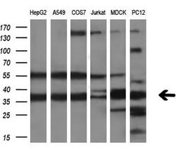 CRYM Mouse anti-Human, Clone: OTI1B5, lyophilized, TrueMAB 100 &mu;g; Unconjugated:Antibodies,