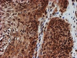 CRYZL1 Mouse anti-Human, Clone: OTI2F9, lyophilized, TrueMAB 100 &mu;g;