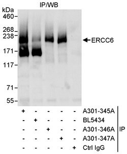 CSB/ERCC6 Rabbit anti-Human, Polyclonal, Bethyl Laboratories 10 &mu;L;
