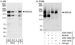 CSB/ERCC6 Rabbit anti-Human, Polyclonal, Bethyl Laboratories 100 &mu;L;