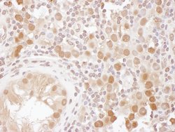 CSE1 Rabbit anti-Human, Mouse, Polyclonal, Bethyl Laboratories 100 &mu;L;