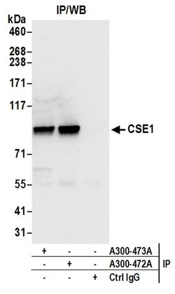 CSE1 Rabbit anti-Human, Mouse, Polyclonal, Bethyl Laboratories 100 &mu;l;