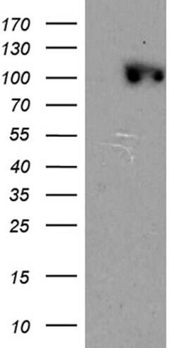 CSE1L Monoclonal Antibody (OTI2C5), TrueMAB , OriGene 100 &mu;L; Unconjugated:Antibodies,