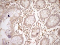 CSF1 Mouse anti-Human, Clone: OTI8E1, liquid, TrueMAB 100 &mu;L | Buy Online | OriGene | Fisher Scientific
