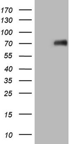 CSF1 Mouse anti-Human, Clone: OTI8E1, liquid, TrueMAB 100 &mu;L | Buy Online | OriGene | Fisher Scientific