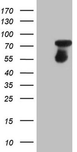 CSF1 Mouse anti-Human, Clone: OTI2D6, TrueMAB , Origene 30 &mu;L; Unconjugated:Antibodies,