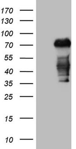 CSF1 Monoclonal Antibody (OTI1F8), TrueMAB , OriGene:Antibodies:Primary