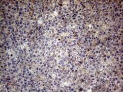 CSF2 Monoclonal Antibody (OTI10G3), TrueMAB , OriGene 100 &mu;L; Unconjugated:Antibodies,