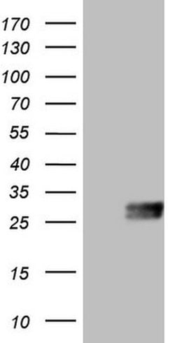 CSF2 Mouse anti-Human, Clone: OTI1A3, lyophilized, TrueMAB 100 &mu;g; Unconjugated:Antibodies,