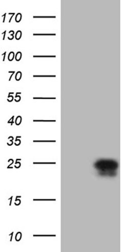 CSF2 Mouse anti-Human, Clone: OTI10G3, lyophilized, TrueMAB 100 &mu;g;