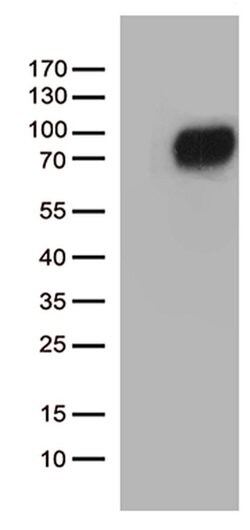 CSF2RA Monoclonal Antibody (OTI2D6), TrueMAB , OriGene 100 &mu;L; Unconjugated:Antibodies,