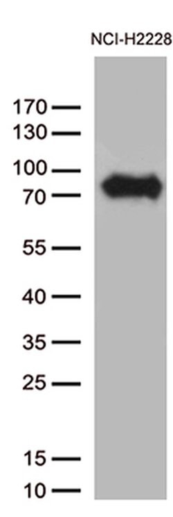 CSF2RA Monoclonal Antibody (OTI2D6), TrueMAB , OriGene 100 &mu;L; Unconjugated:Antibodies,